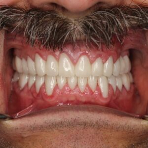 WhatsApp Image 2023-02-03 at 3.44.42 PM