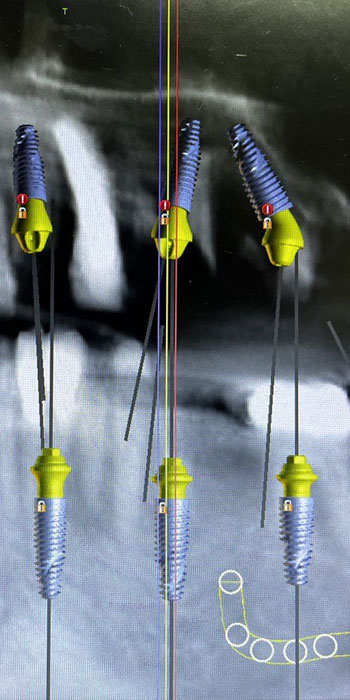 Alt Text for FullArch